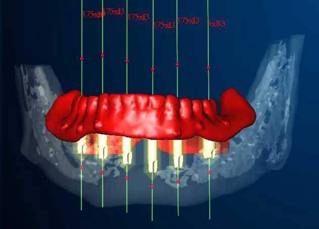 Dental Technology in Carlisle, MA